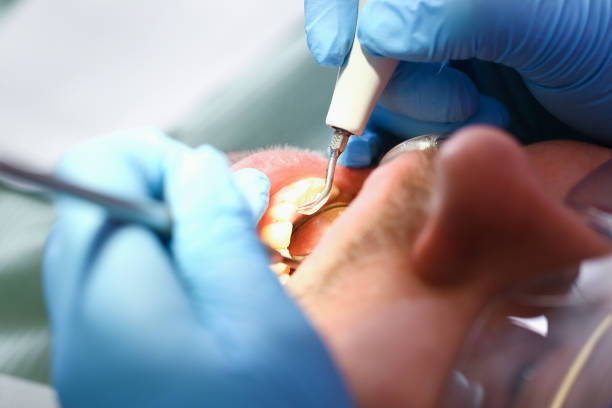 Professional Emergency Dental Service in IN