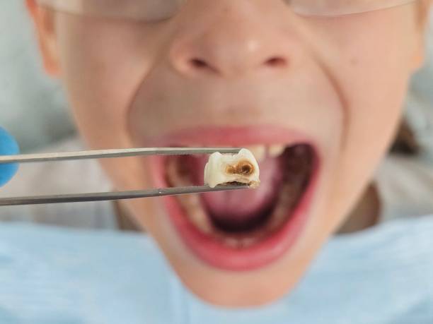 Best Weekend Emergency Dental Services in Bluffton, IN